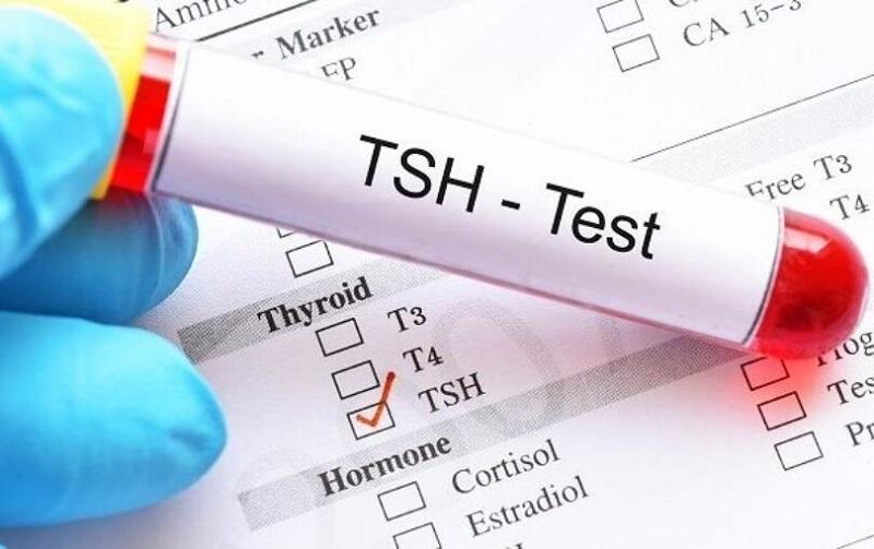xét nghiệm TSH