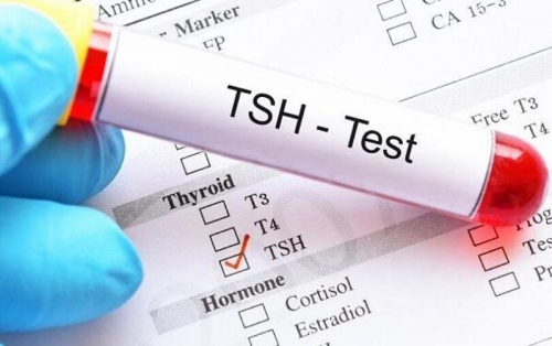 Nghiên cứu mới nhất về TSH và bệnh ung thư tuyến giáp của các nhà khoa học Mỹ