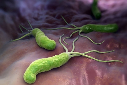 Sơ lược về vi khuẩn Helicobacter pylori